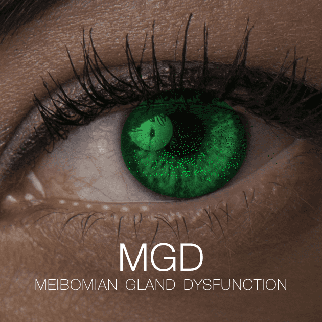 Meibomian Gland Dysfunction